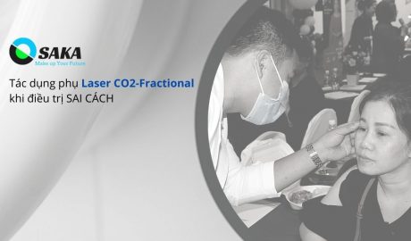 Tác dụng phụ điều trị Laser CO2 Fractional sai cách