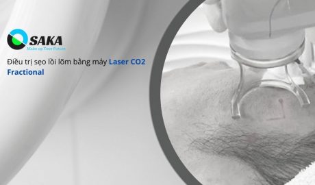 Điều trị sẹo bằng Laser CO2 Fractional