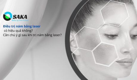 Điều trị nám bằng laser có hiệu quả không