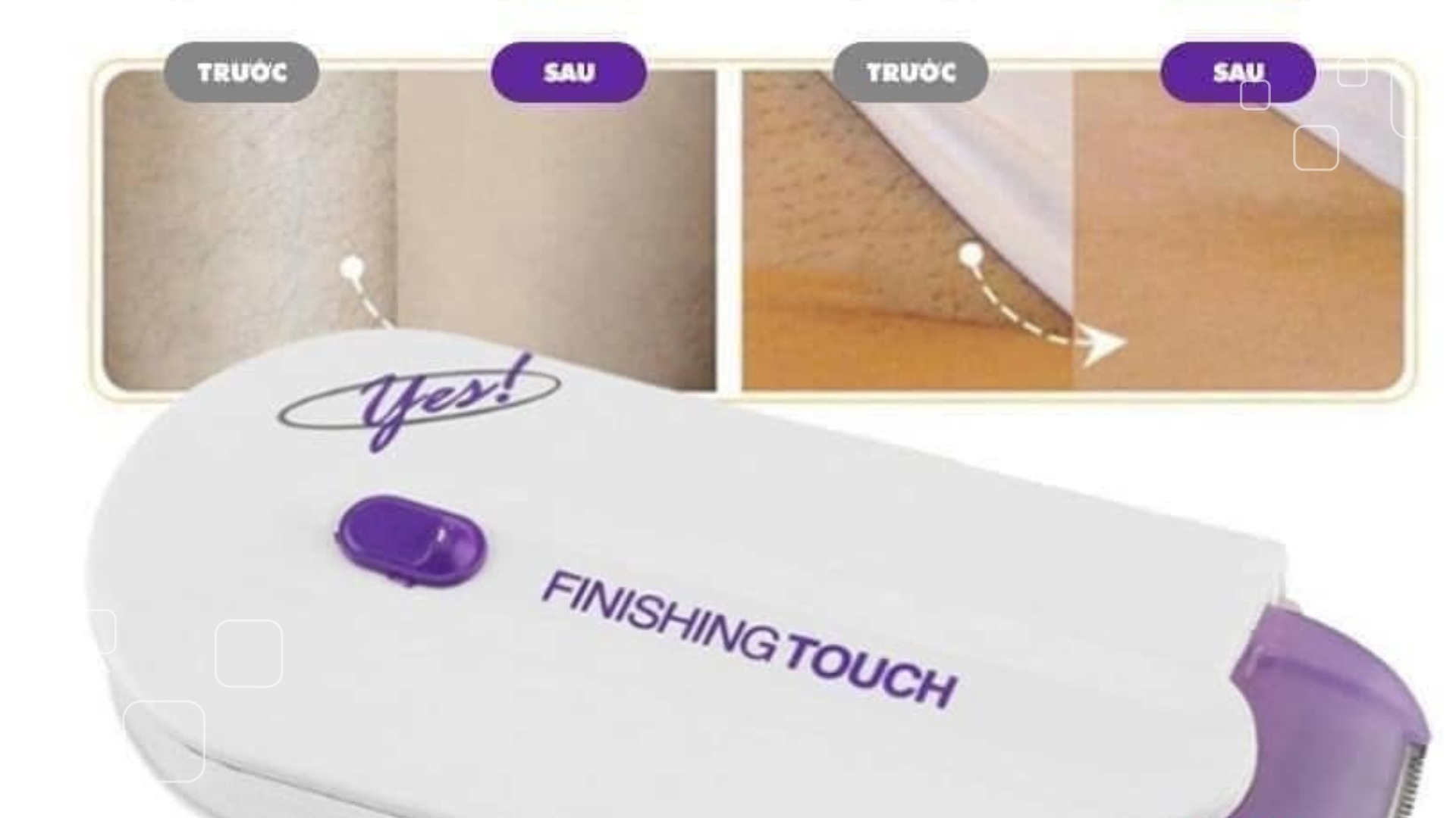 Lưu ý khi sử dụng máy triệt lông Yes Finishing Touch
