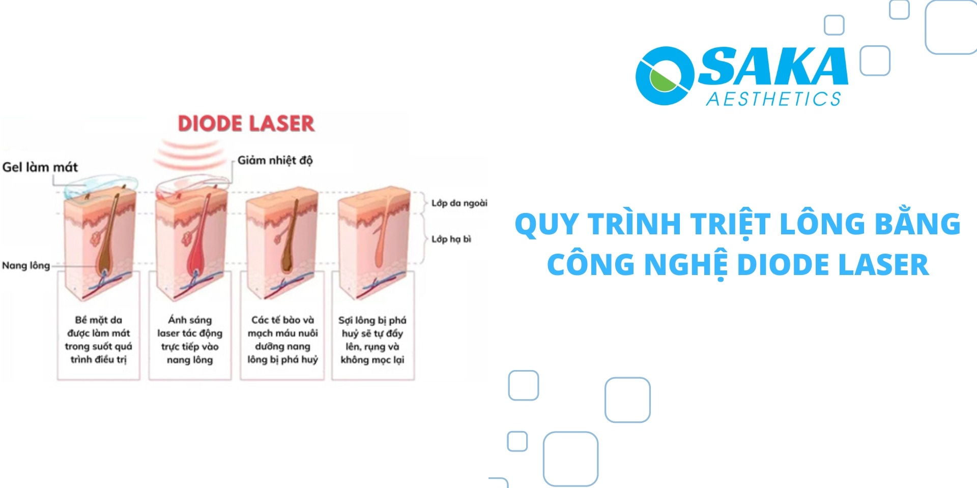 Quy trình triệt lông bằng công nghệ Diode laser