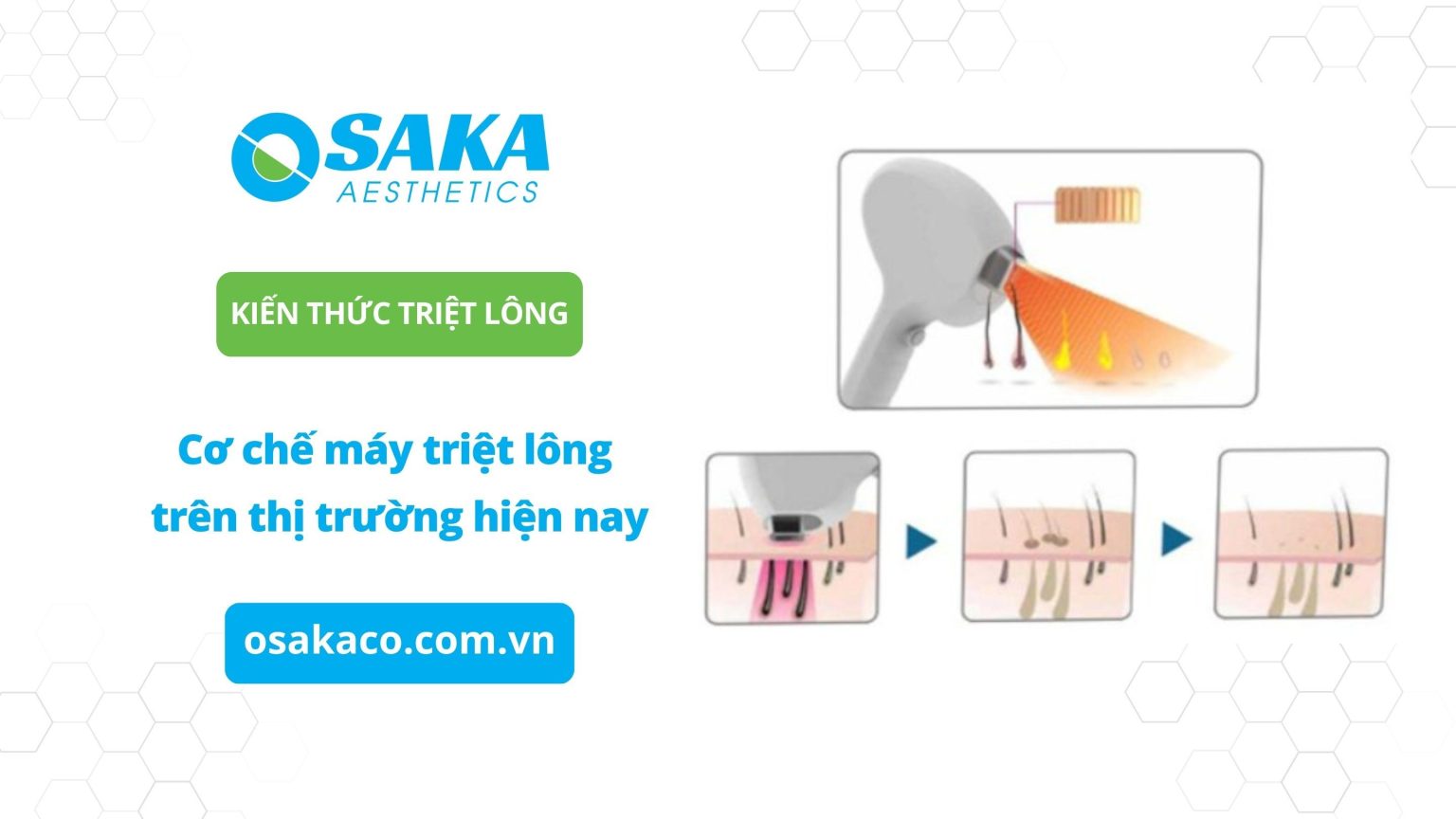 Tìm hiểu về cơ chế máy triệt lông trên thị trường hiện nay