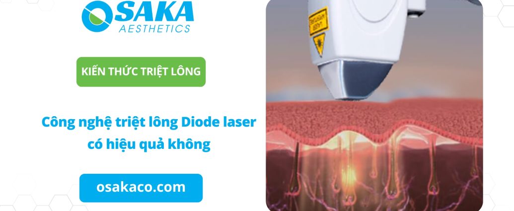 Công nghệ triệt lông Diode laser có hiệu quả không