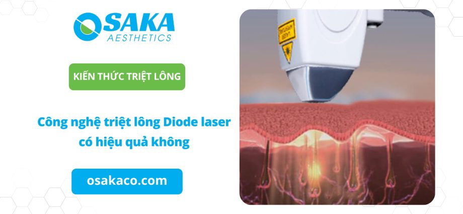 Công nghệ triệt lông Diode Laser có hiệu quả không