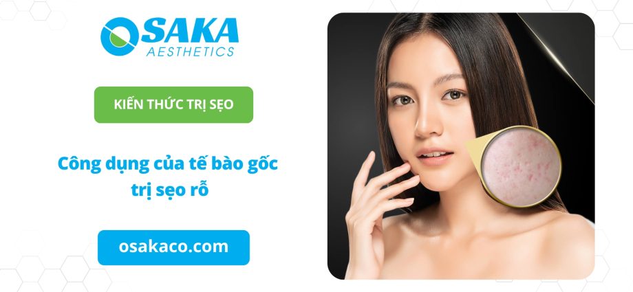Công dụng của tế bào gốc trị sẹo rỗ