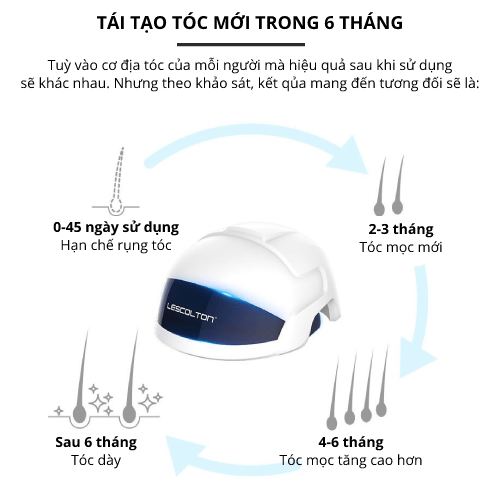 Nón Laser Mọc Tóc Giảm Dầu Chân Tóc - LESCOLTON