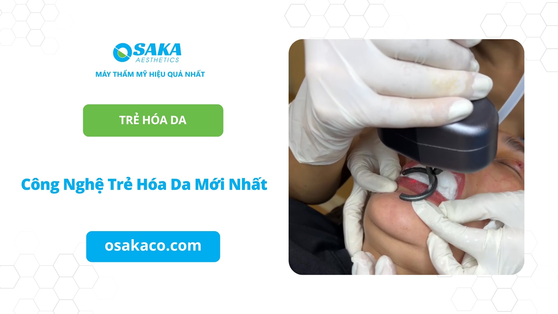 Công nghệ trẻ hóa da mới nhất