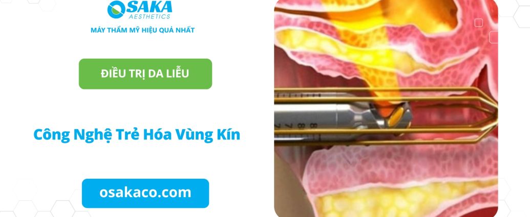 Công nghệ trẻ hóa vùng kín