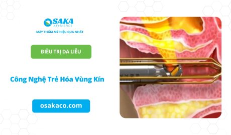 Công Nghệ Trẻ Hóa Vùng Kín