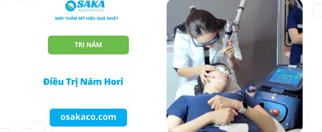 Điều Trị Nám Hori