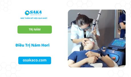 Điều Trị Nám Hori