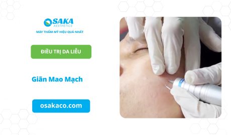 Giãn mao mạch
