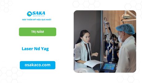 Laser Nd Yag