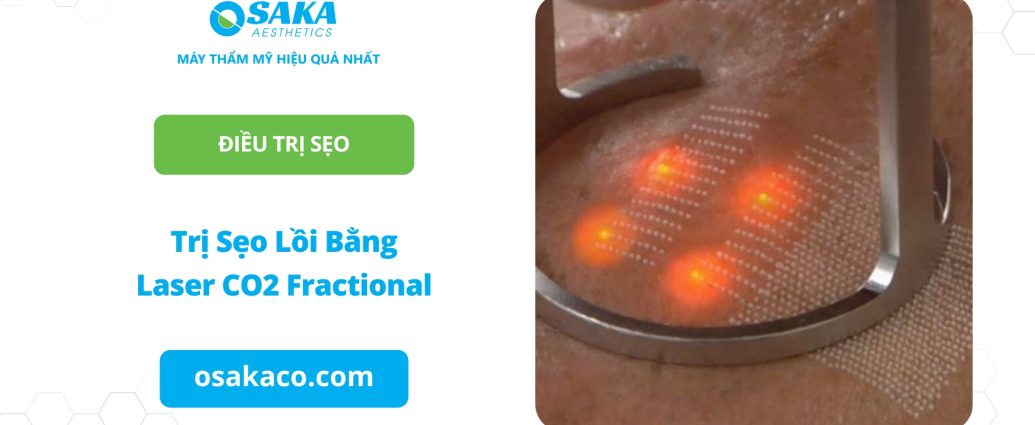 Trị sẹo lồi bằng Laser CO2 Fractional