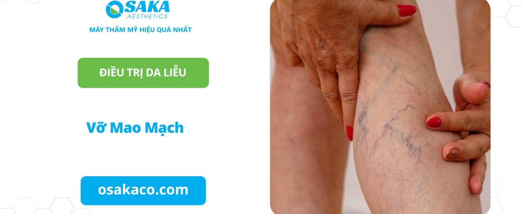 Vỡ mao mạch dưới da