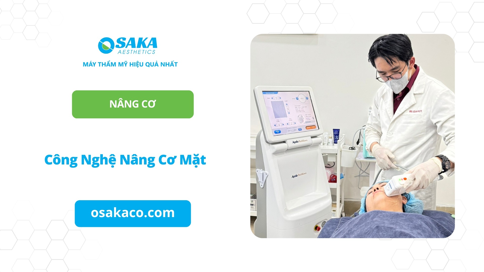 Công nghệ nâng cơ mặt