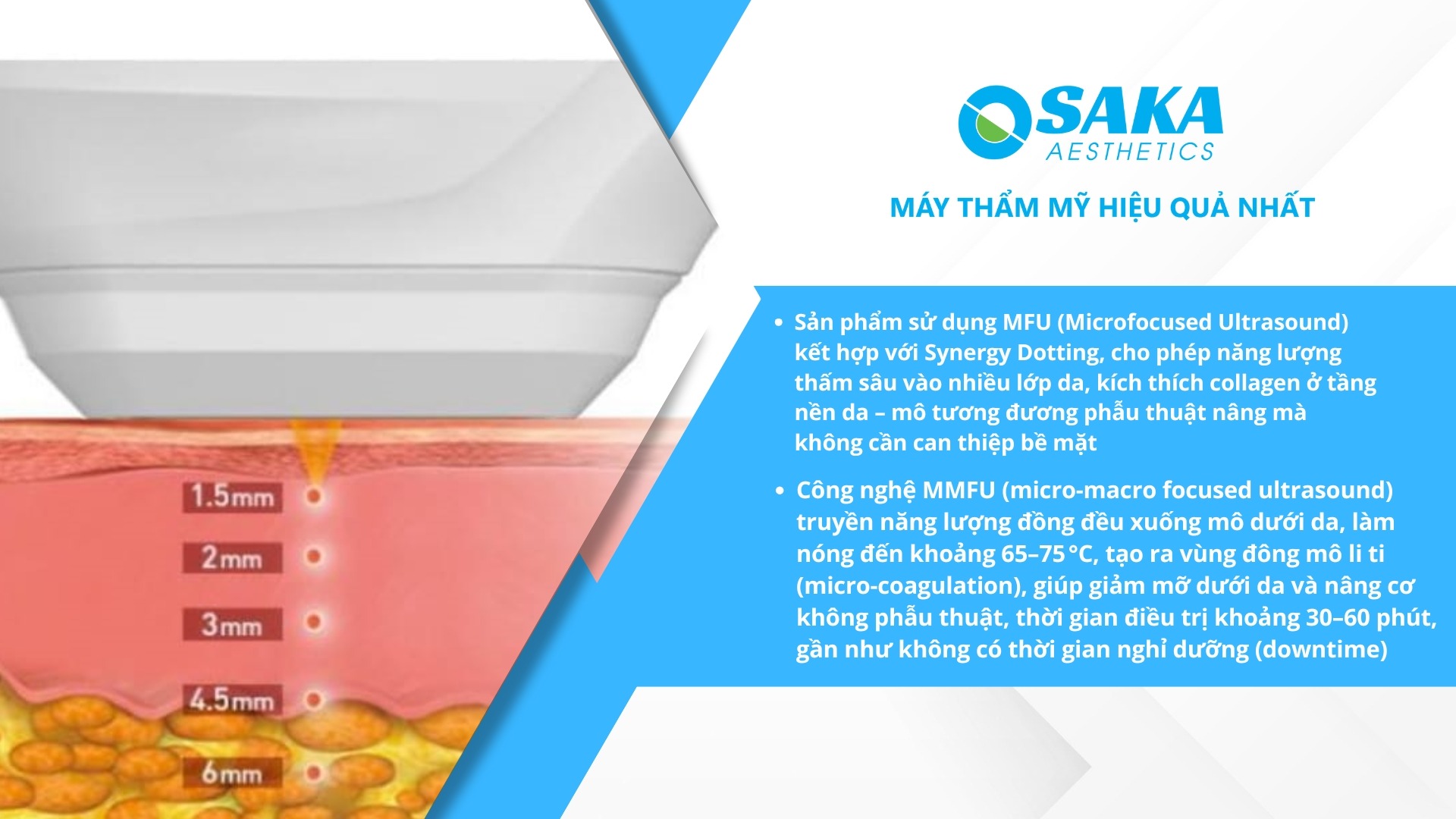Nguyên lý hoạt động công nghệ máy nâng cơ HIFU COOL GLAMOR