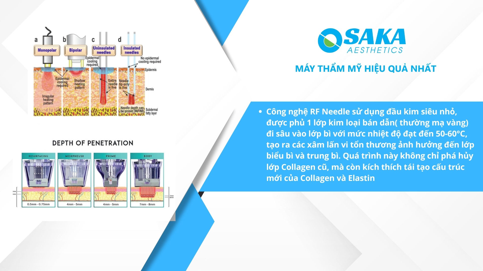 Nguyên lý hoạt động Máy RF Vi Kim Quantus Plus Italy