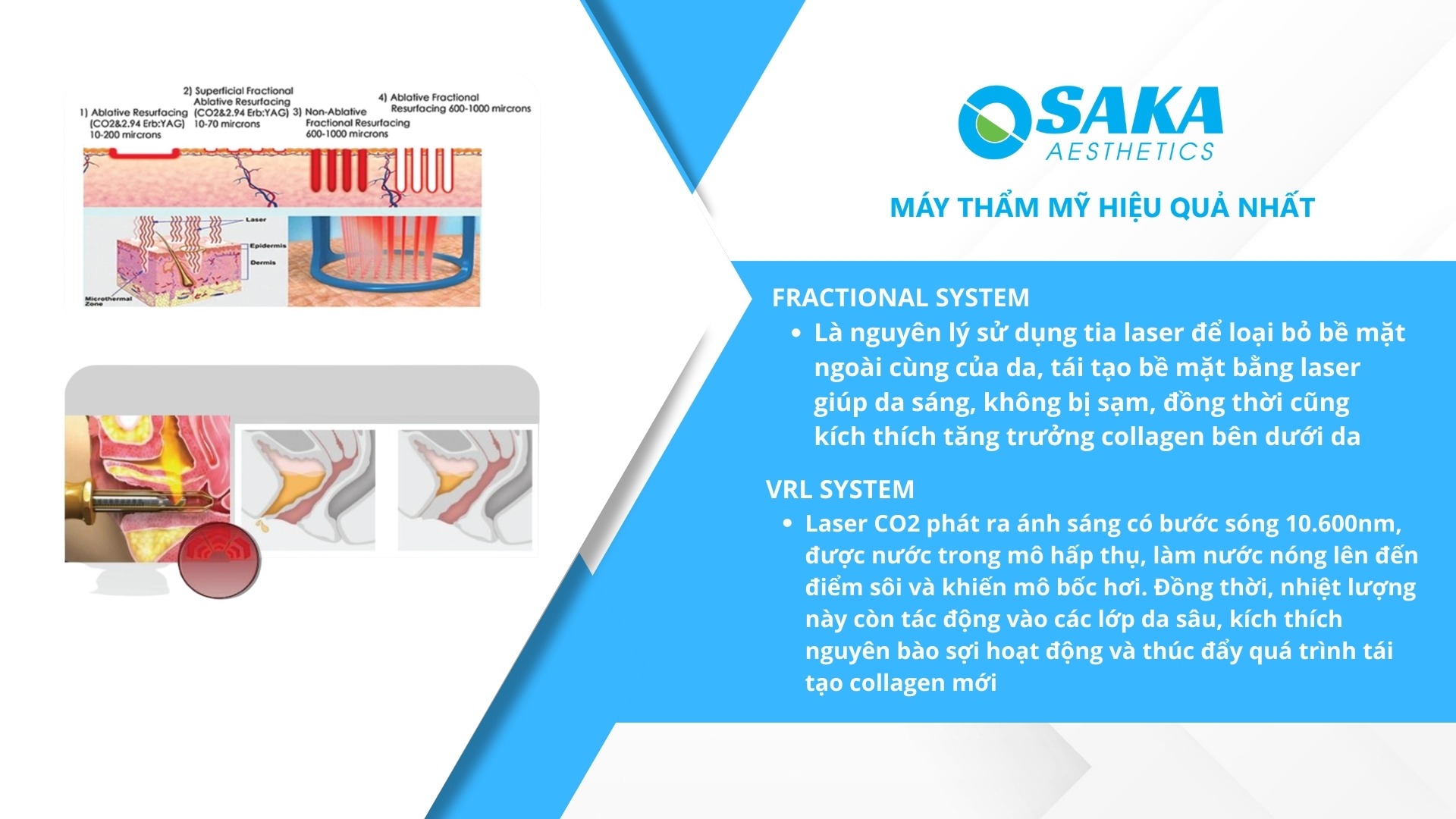 Máy Trị Sẹo, Trẻ Hóa Da Laser CO2 Fractional OSAKA DERMACLEAR Model FG900S Android Nguyên lý hoạt động Máy Trị Sẹo, Trẻ Hóa Da Laser CO2 Fractional OSAKA DERMACLEAR Model FG900S Android