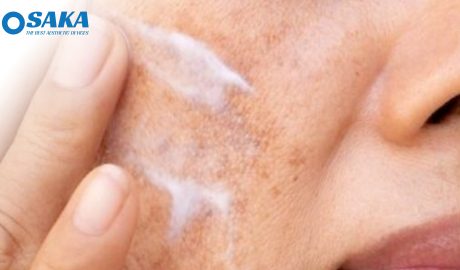 Chăm sóc da sau điều trị Laser CO2 Fractional Chăm sóc da sau điều trị Laser CO2 Fractional