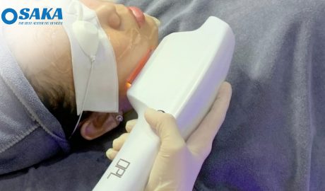 Công nghệ triệt lông – Giải pháp tối ưu cho làn da mịn màng Công nghệ triệt lông – Giải pháp tối ưu cho làn da mịn màng