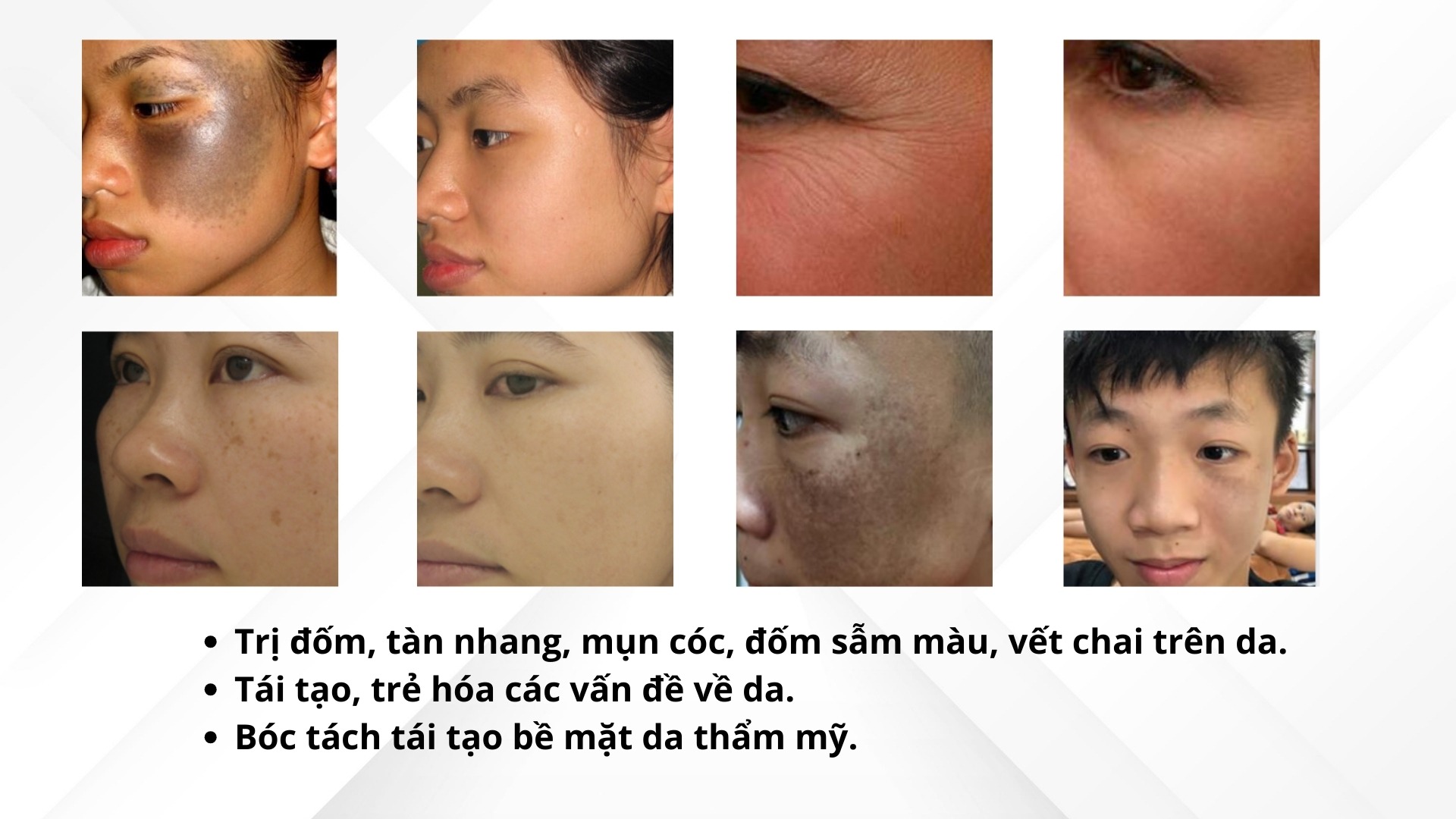 Máy Trị Sẹo, Trẻ Hóa Da Laser CO2 Fractional OSAKA DERMACLEAR Model FG900S Android Trẻ hóa da