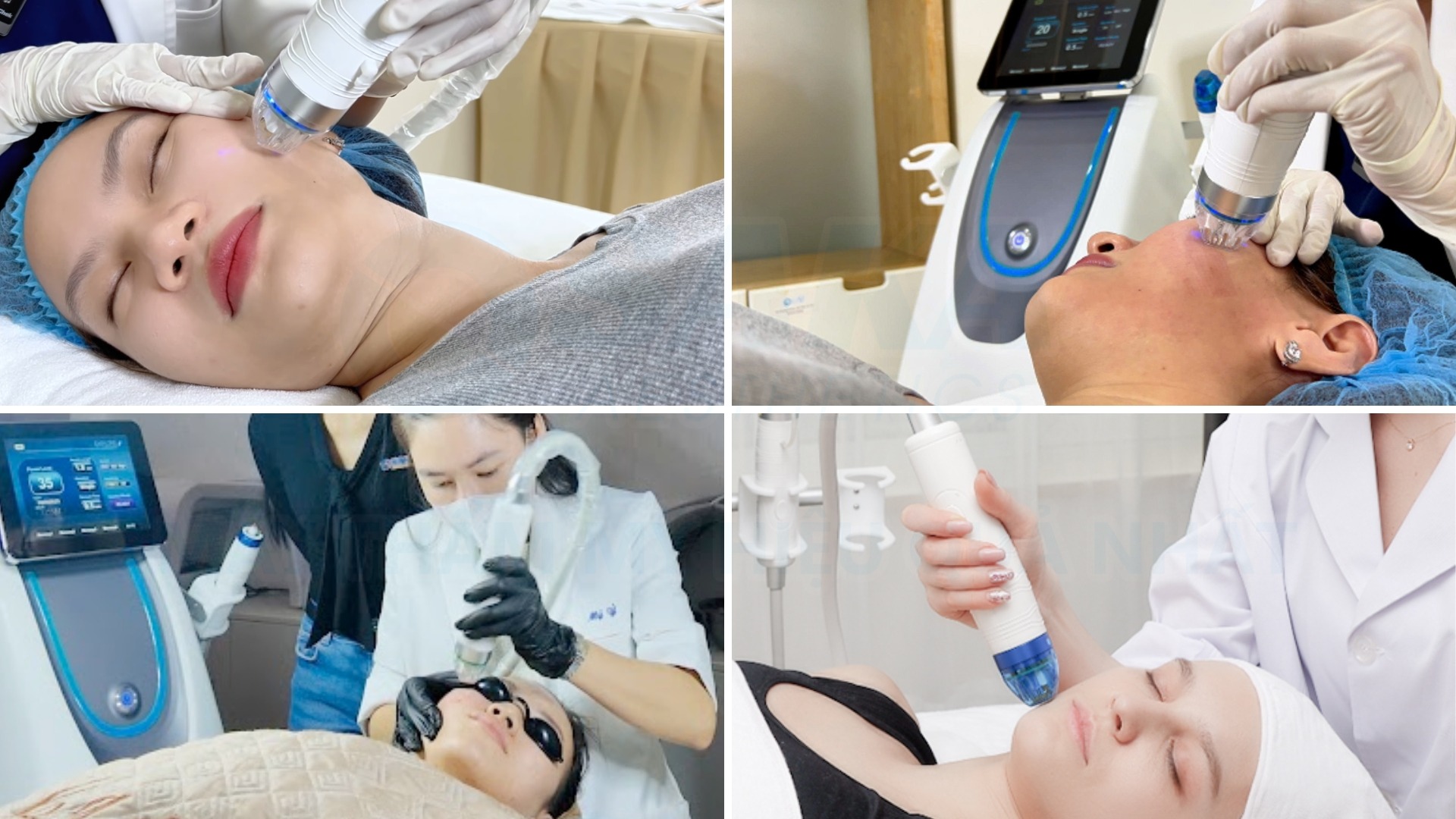 Lâm sàng công nghệ RF Needle