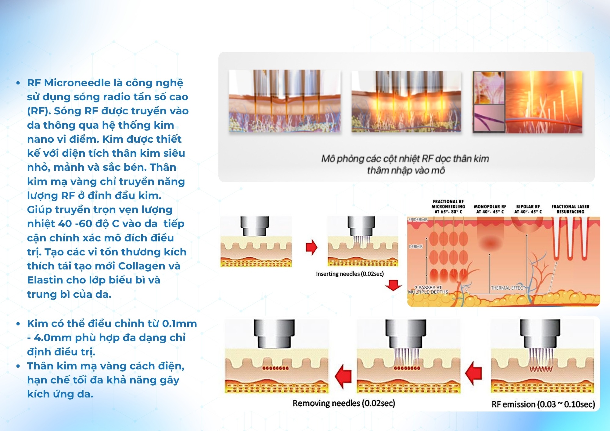Máy RF Needle Quantus Plus Italy Model H2 Giới thiệu Máy RF Needle Quantus Plus Italy