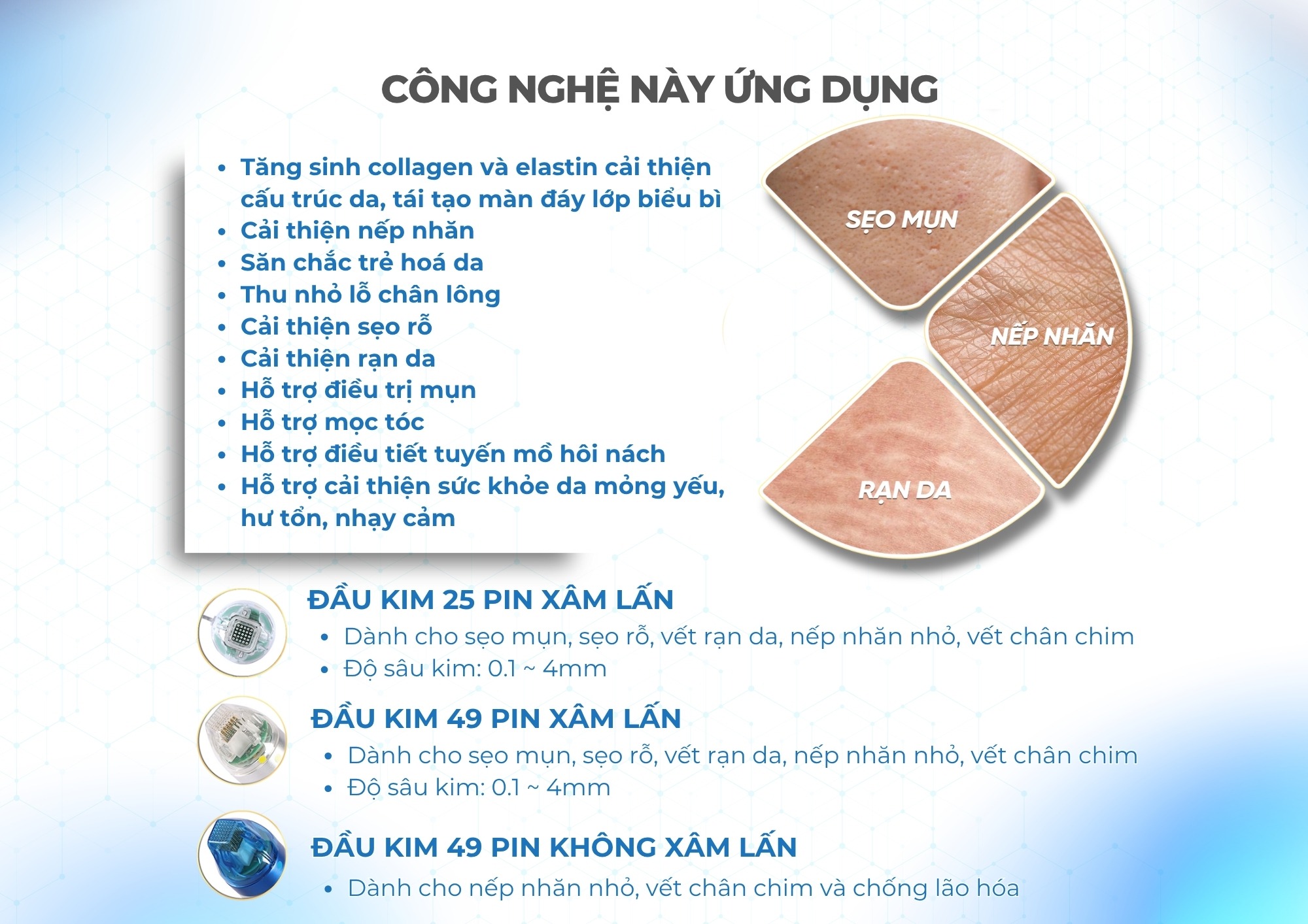 Máy RF Needle Quantus Plus Italy Model H2 Ứng dụng Máy RF Needle Quantus Plus Italy