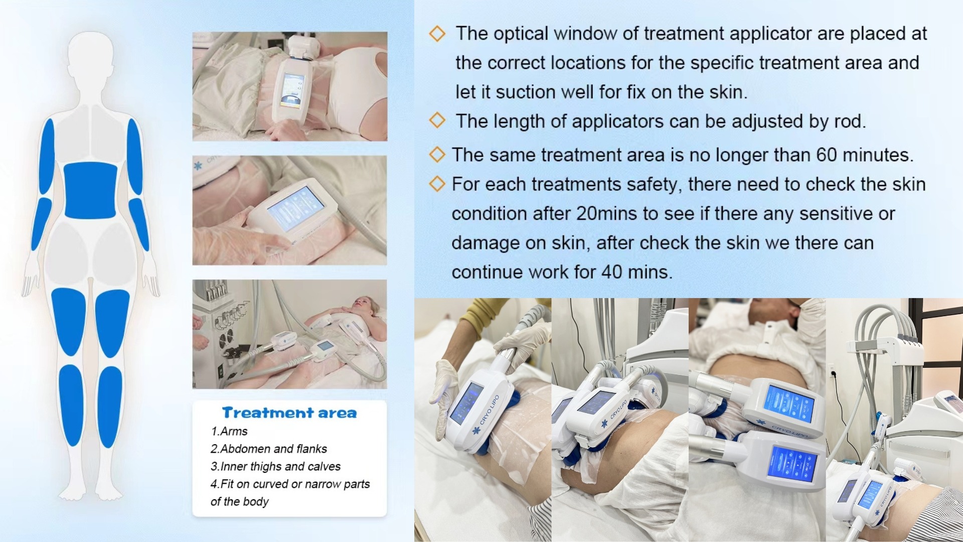 Máy Giảm Béo Quang Đông Apolo Cryoslim Model HS580 Quy trình điều trị