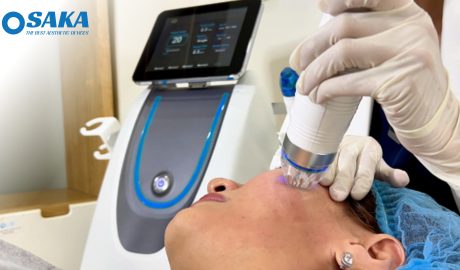 RF Microneedle là gì? Tác dụng, hiệu quả vượt trội RF Microneedle là gì? Tác dụng, hiệu quả vượt trội